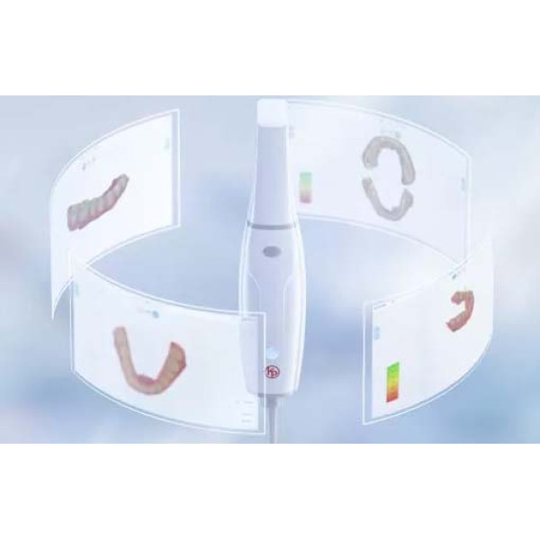 Сканер інтраоральний "Smile Scan" KP